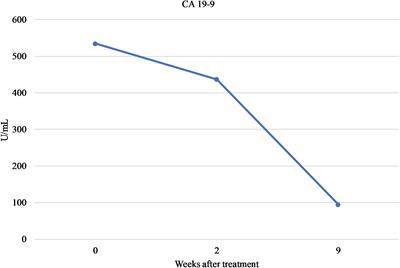 Clinical Value of Pharmacogenomic Testing in a Patient Receiving FOLFIRINOX for Pancreatic Adenocarcinoma